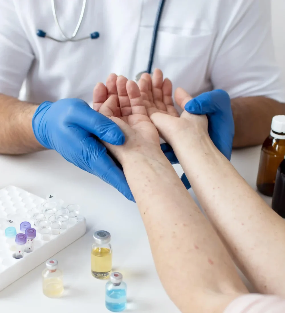 skin-allergy-person-s-arms